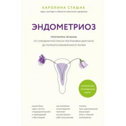 Эндометриоз. Программа лечения. От самодиагностики и постановки диагноза до избавления от болей