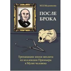 После Брока. Трепанации эпохи неолита из коллекции Прюньера в Музее Человека в Париже