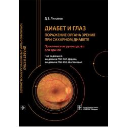 Диабет и глаз. Поражение органа зрения при сахарном диабете