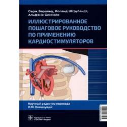 Иллюстрированное пошаговое руководство по применению кардиостимуляторов