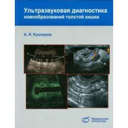 Ультразвуковая диагностика новообразований толстой кишки