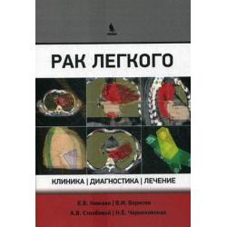 Рак легкого. Клиника, диагностика, лечение